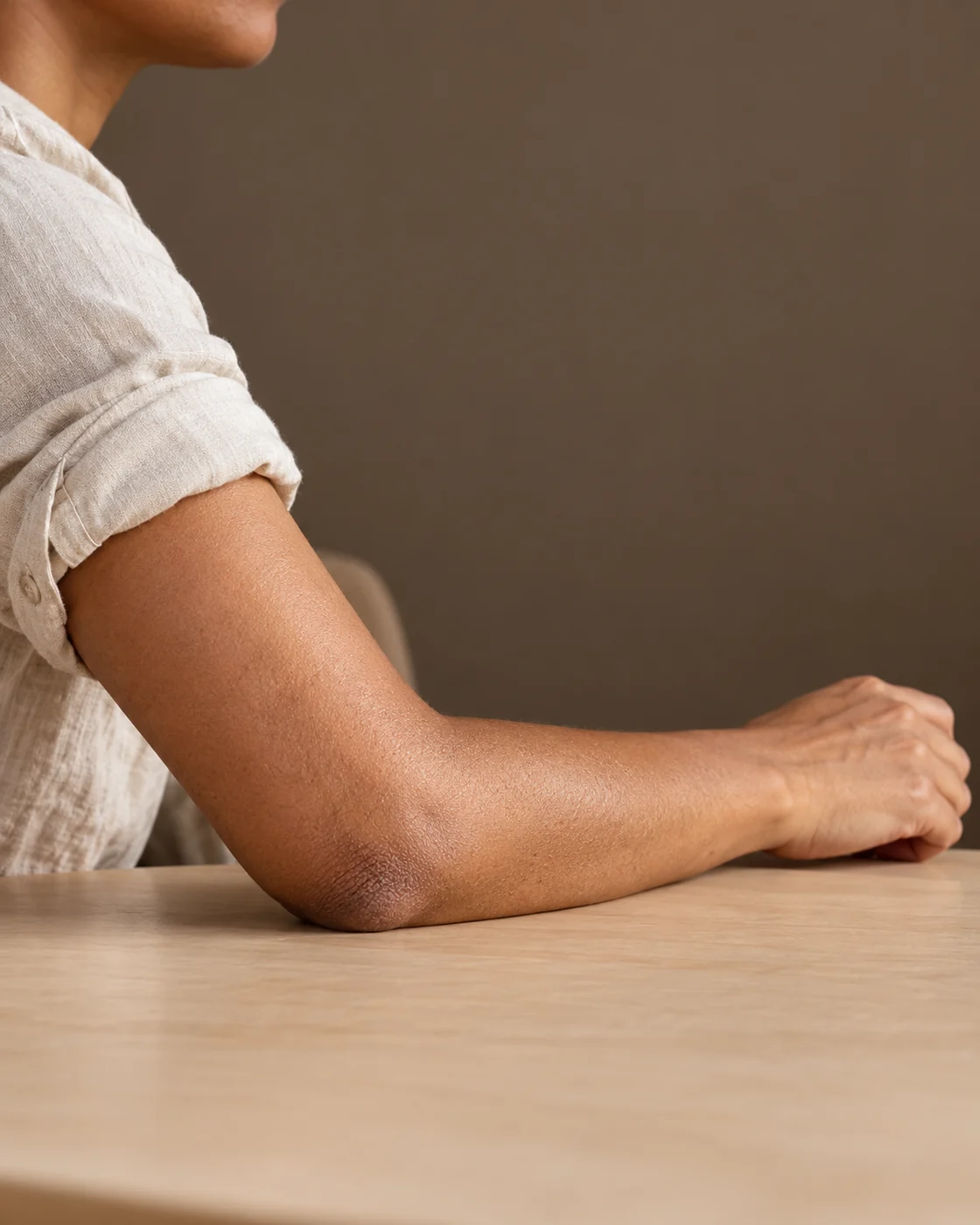 Bras plié dont le coude naturellement pigmenté repose sur un bureau, avant-bras et main visibles